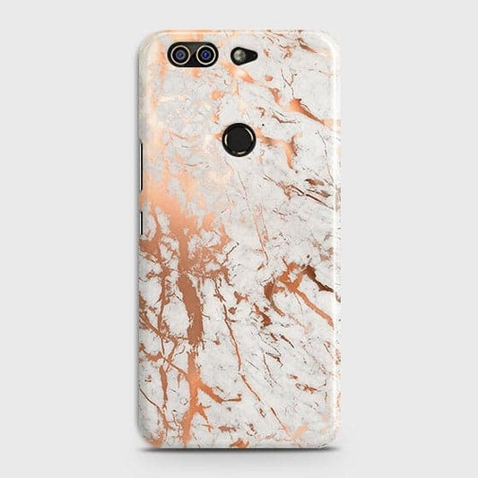 Infinix Zero 5 Pro Cover - In Chic Rose Gold Chrome Style Printed Hard Case with Life Time Colors Guarantee