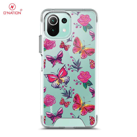 Xiaomi Mi 11 Lite Cover - O'Nation Butterfly Dreams Series - 9 Designs - Clear Phone Case - Soft Silicon Bordersx