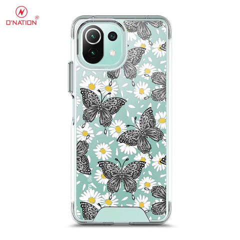 Xiaomi Mi 11 Lite Cover - O'Nation Butterfly Dreams Series - 9 Designs - Clear Phone Case - Soft Silicon Bordersx
