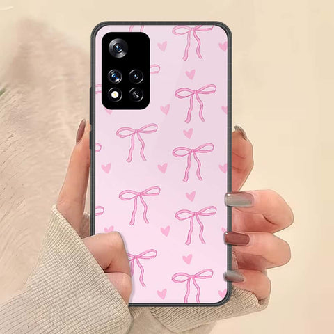 Xiaomi Redmi Note 11 Pro Plus 5G Cover - ONation Bow Series - HQ Ultra Shine Premium Infinity Glass Soft Silicon Borders Case