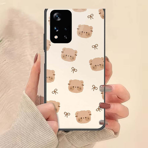 Xiaomi Redmi Note 11 5G Cover - ONation Bow Series - HQ Ultra Shine Premium Infinity Glass Soft Silicon Borders Case