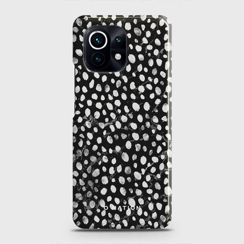 Xiaomi 11 Lite 5G NE Cover - Bold Dots Series - Matte Finish - Snap On Hard Case with LifeTime Colors Guarantee