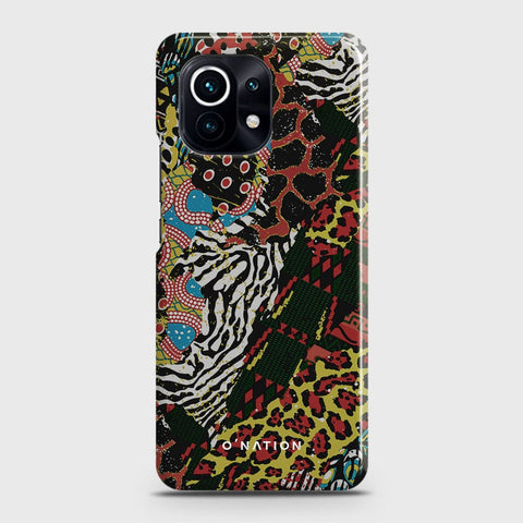 Xiaomi 11 Lite 5G NE Cover - Bold Dots Series - Matte Finish - Snap On Hard Case with LifeTime Colors Guarantee