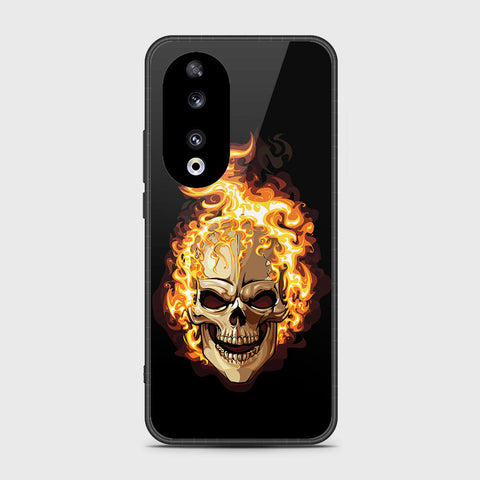 Honor 90 - Stellar Series - HQ Premium Shine Durable Shatterproof Case