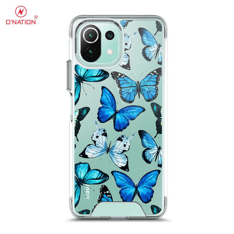 Xiaomi Mi 11 Lite Cover - O'Nation Butterfly Dreams Series - 9 Designs - Clear Phone Case - Soft Silicon Bordersx