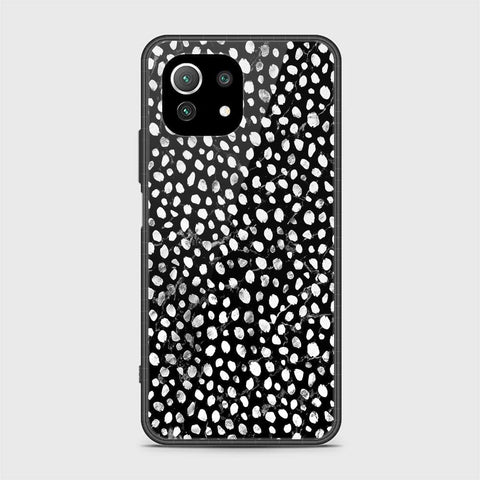 Xiaomi Mi 11 Lite Cover - Vanilla Dream Series - HQ Ultra Shine Premium Infinity Glass Soft Silicon Borders Case