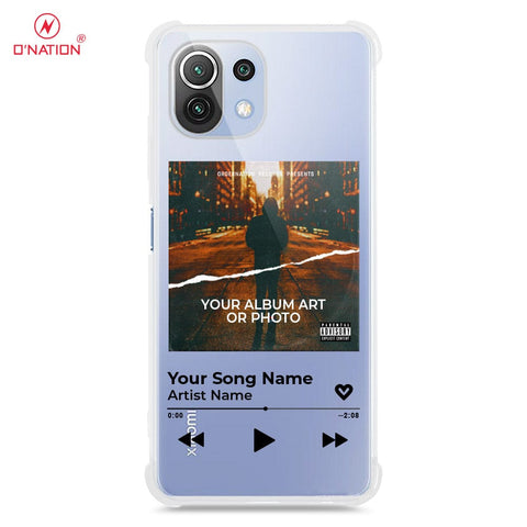 Xiaomi Mi 11 Lite Cover - Personalised Album Art Series - 4 Designs - Clear Phone Case - Soft Silicon Borders