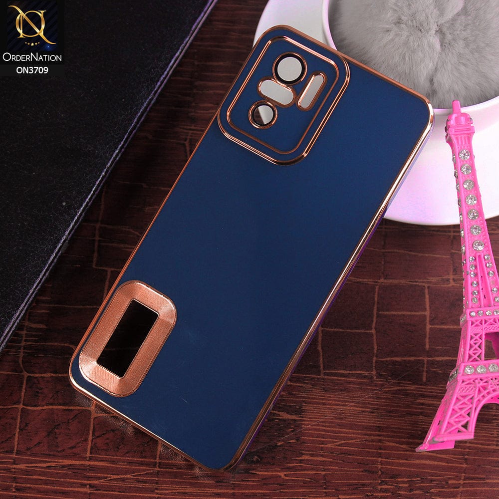 Xiaomi Redmi Note 10S Cover - Blue - All New Electroplating Borders With Logo Hole Camera Protection Soft Silicon Case